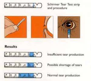 basal tear secretion test|Schirmer Test .